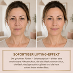 Elysarne Serum – Produktgalerie