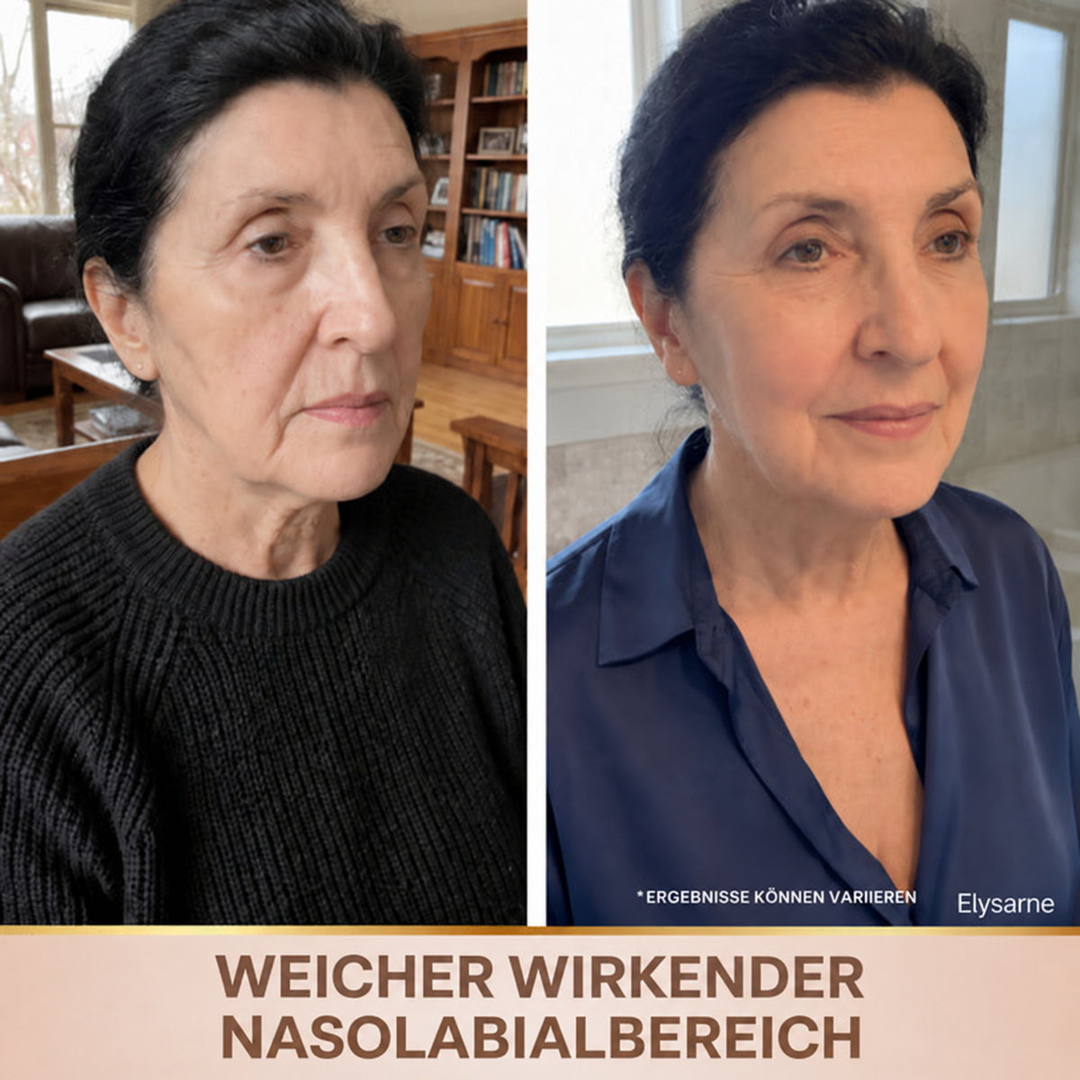 Elysarne Serum – Produktgalerie
