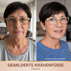 Elysarne Serum – Produktgalerie