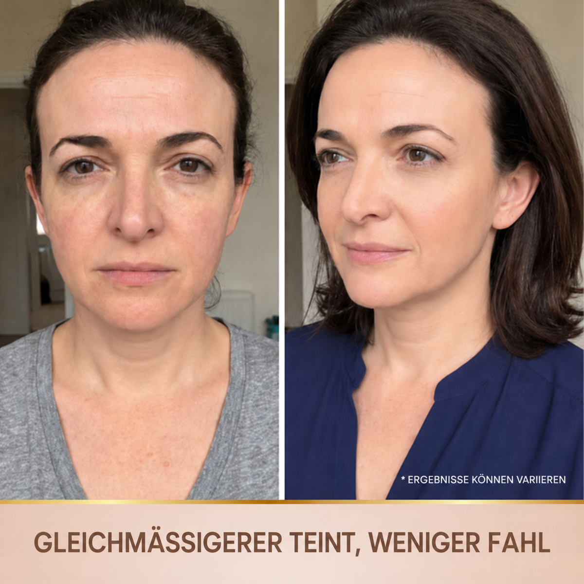 Elysarne Serum – Produktgalerie