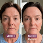 Elysarne Kollagen-Maske – Abbildung 3, deutscher Entwurf
